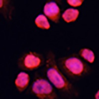 CHAMP1 Rabbit Polyclonal Antibody