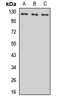 POLR1B Rabbit Polyclonal Antibody