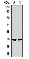 SPRR3 Rabbit Polyclonal Antibody