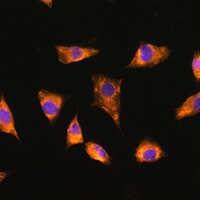 SPRR3 Rabbit Polyclonal Antibody