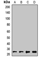 RAB21 Rabbit Polyclonal Antibody