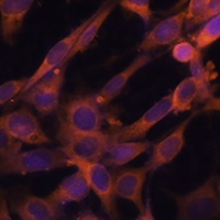 RAB21 Rabbit Polyclonal Antibody