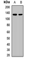 SART3 Rabbit Polyclonal Antibody