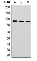 DNAJC10 Rabbit Polyclonal Antibody
