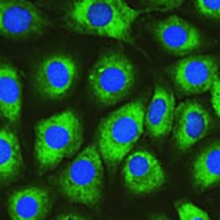 DNAJC10 Rabbit Polyclonal Antibody