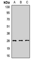 SNRPA1 Rabbit Polyclonal Antibody