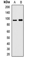 PDE8A Rabbit Polyclonal Antibody