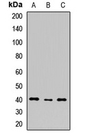 SHARPIN Rabbit Polyclonal Antibody