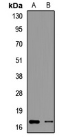 PFDN2 Rabbit Polyclonal Antibody