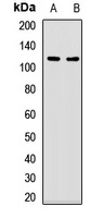 UBA1 Rabbit Polyclonal Antibody