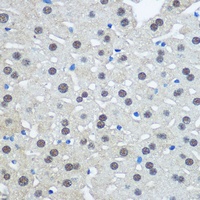 UBA1 Rabbit Polyclonal Antibody