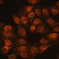 UBA1 Rabbit Polyclonal Antibody