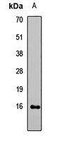 Leptin Rabbit Polyclonal Antibody