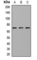 CETP Rabbit Polyclonal Antibody