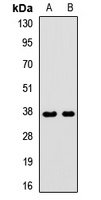 GNB3 Rabbit Polyclonal Antibody