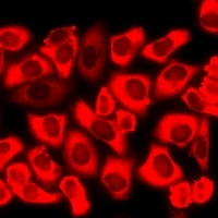 CHRM2 Rabbit Polyclonal Antibody