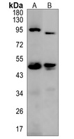 Haptoglobin Rabbit Polyclonal Antibody