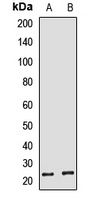 HBEGF Rabbit Polyclonal Antibody
