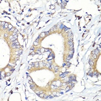 HBEGF Rabbit Polyclonal Antibody
