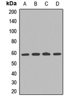 IFNAR2 Rabbit Polyclonal Antibody