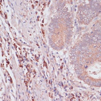 IFNAR2 Rabbit Polyclonal Antibody