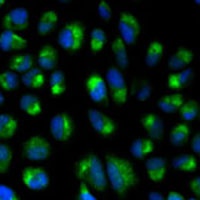 IFNAR2 Rabbit Polyclonal Antibody