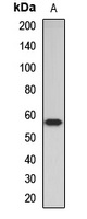 ACVR2A Rabbit Polyclonal Antibody