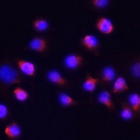 ACVR2A Rabbit Polyclonal Antibody