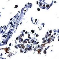 IL-13 Rabbit Polyclonal Antibody
