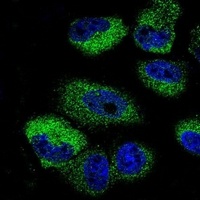 IL-13 Rabbit Polyclonal Antibody