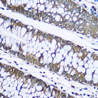 UBB Rabbit Polyclonal Antibody