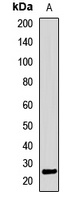 ALKBH7 Rabbit Polyclonal Antibody