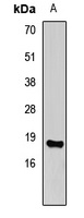 Histone H3 (MonoMethyl-K4) Rabbit Polyclonal Antibody