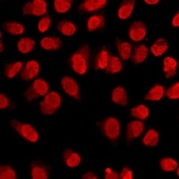 Histone H3 (MonoMethyl-K4) Rabbit Polyclonal Antibody