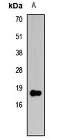 Histone H3 (DiMethyl-K4) Rabbit Polyclonal Antibody