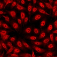 Histone H3 (DiMethyl-K4) Rabbit Polyclonal Antibody