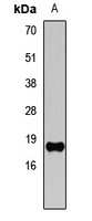 Histone H3 (TriMethyl-K4) Rabbit Polyclonal Antibody
