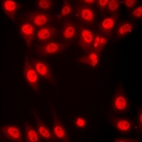 Histone H3 (TriMethyl-K4) Rabbit Polyclonal Antibody