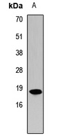 Histone H3 (MonoMethyl-K9) Rabbit Polyclonal Antibody