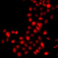 Histone H3 (MonoMethyl-K9) Rabbit Polyclonal Antibody