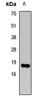 Histone H3 (DiMethyl-K79) Rabbit Polyclonal Antibody