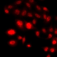 Histone H3 (DiMethyl-K79) Rabbit Polyclonal Antibody