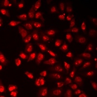 Histone H3 (TriMethyl-K9) Rabbit Polyclonal Antibody