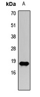 Histone H3 (TriMethyl-K27) Rabbit Polyclonal Antibody