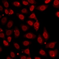 Histone H3 (TriMethyl-K27) Rabbit Polyclonal Antibody