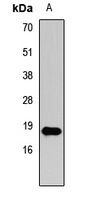 Histone H3 (TriMethyl-K27) Rabbit Polyclonal Antibody