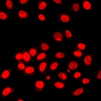 Histone H3 (TriMethyl-K27) Rabbit Polyclonal Antibody