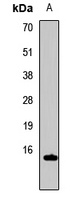 Histone H3 (DiMethyl-K79) Rabbit Polyclonal Antibody