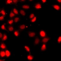 Histone H3 (DiMethyl-K79) Rabbit Polyclonal Antibody