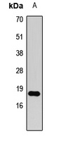 Histone H3 (DiMethyl-K79) Rabbit Polyclonal Antibody